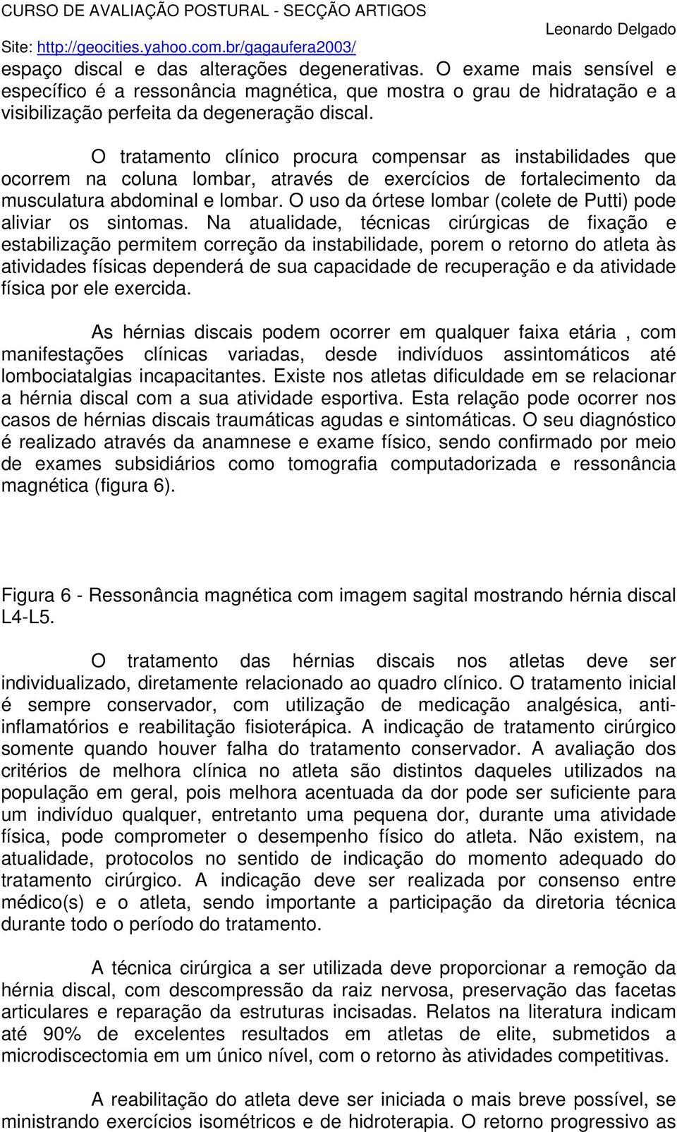 O uso da órtese lombar (colete de Putti) pode aliviar os sintomas.