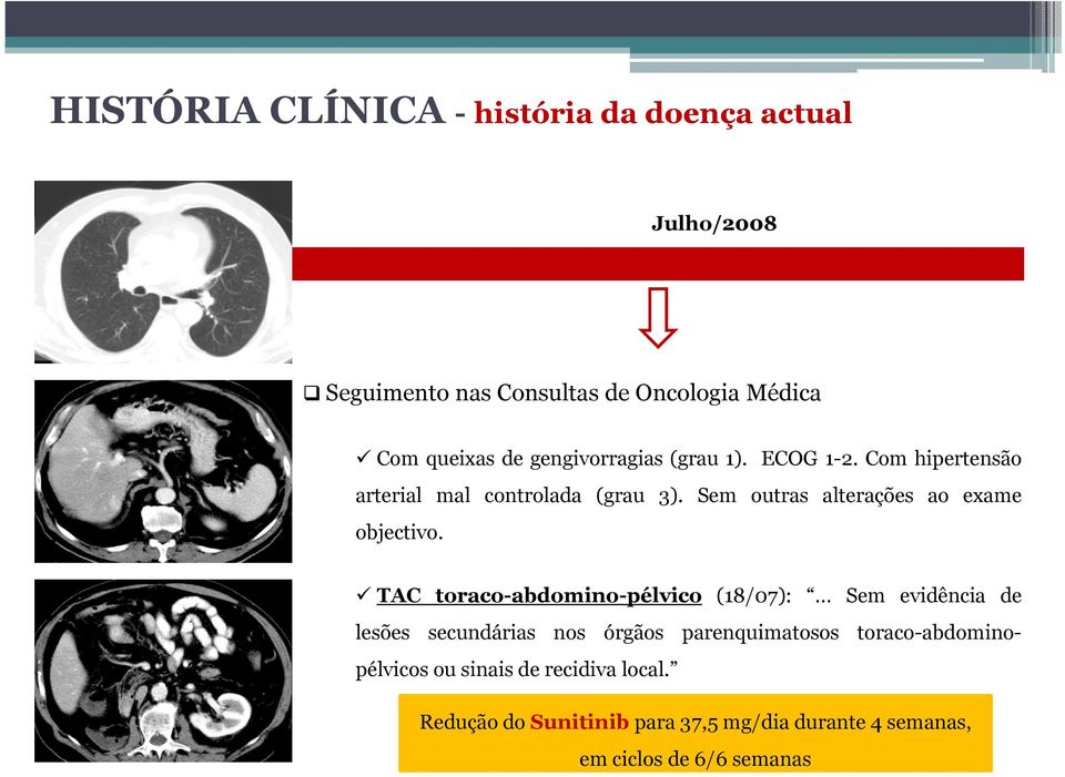 TAC toraco-abdomino-pélvico (18/07): Sem evidência de lesões secundárias nos órgãos