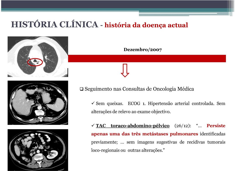 TAC toraco-abdomino-pélvico (26/12): Persiste apenas uma das três metástases