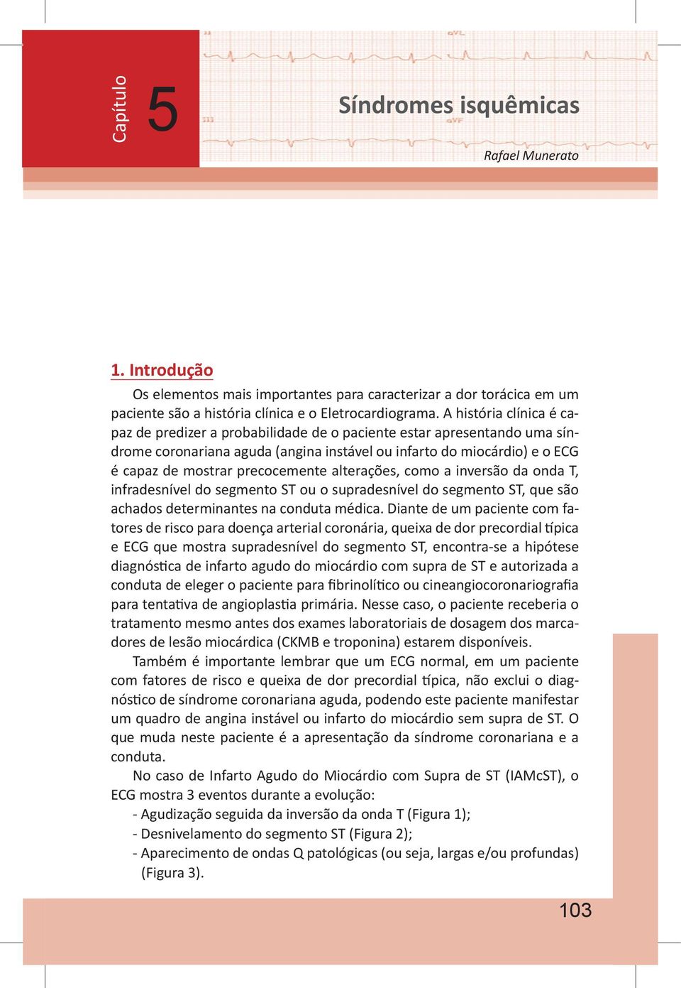 precocemente alterações, como a inversão da onda T, infradesnível do segmento ST ou o supradesnível do segmento ST, que são achados determinantes na conduta médica.