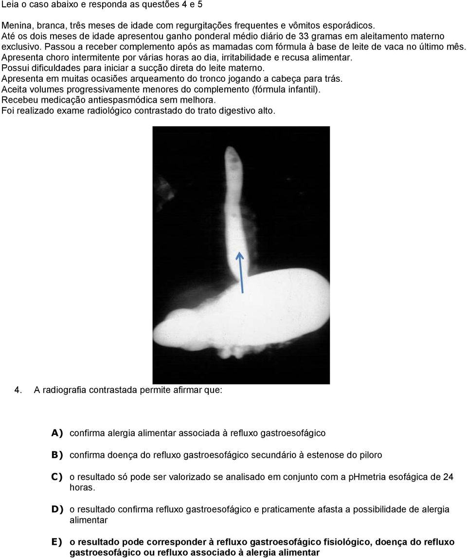 Passou a receber complemento após as mamadas com fórmula à base de leite de vaca no último mês. Apresenta choro intermitente por várias horas ao dia, irritabilidade e recusa alimentar.