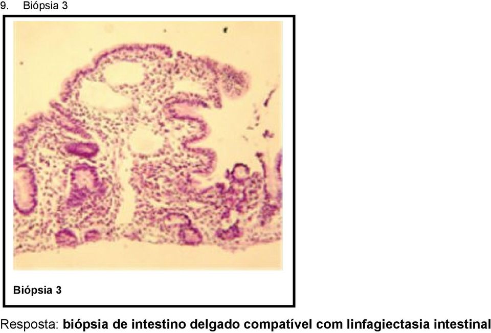 intestino delgado