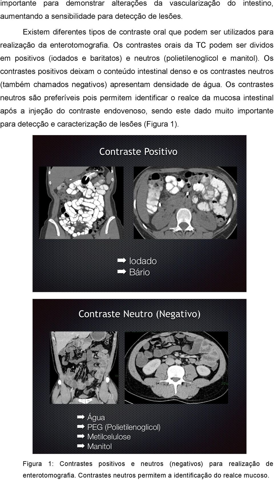 Os contrastes orais da TC podem ser dividos em positivos (iodados e baritatos) e neutros (polietilenoglicol e manitol).