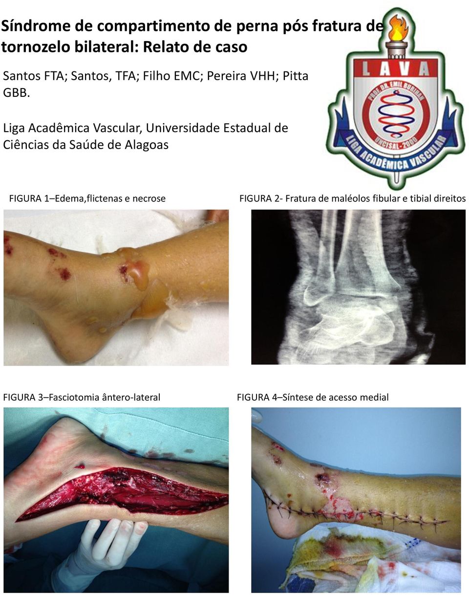 maléolos fibular e tibial direitos FIGURA 3