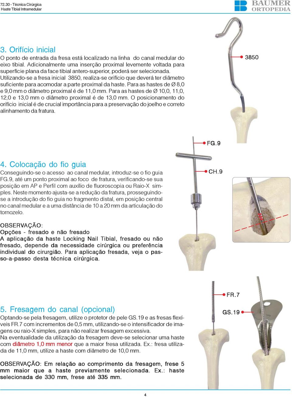 Utilizando-se a fresa inicial 3850, realiza-se orifício que deverá ter diâmetro suficiente para acomodar a parte proximal da haste. Para as hastes de Ø 8,0 e 9,0 mm o diâmetro proximal é de 11,0 mm.