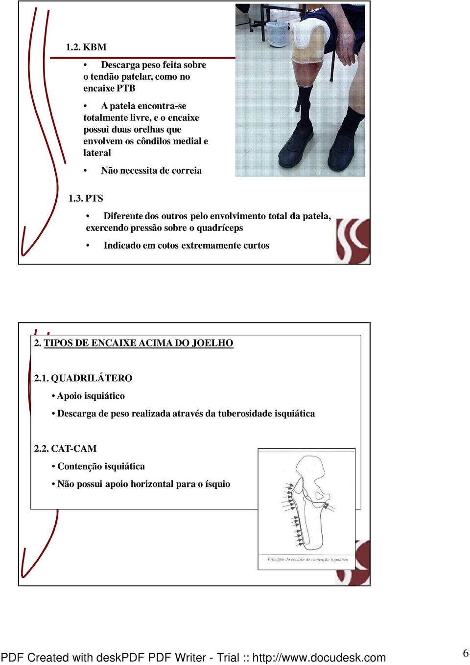 PTS Diferente dos outros pelo envolvimento total da patela, exercendo pressão sobre o quadríceps Indicado em cotos extremamente curtos 2.