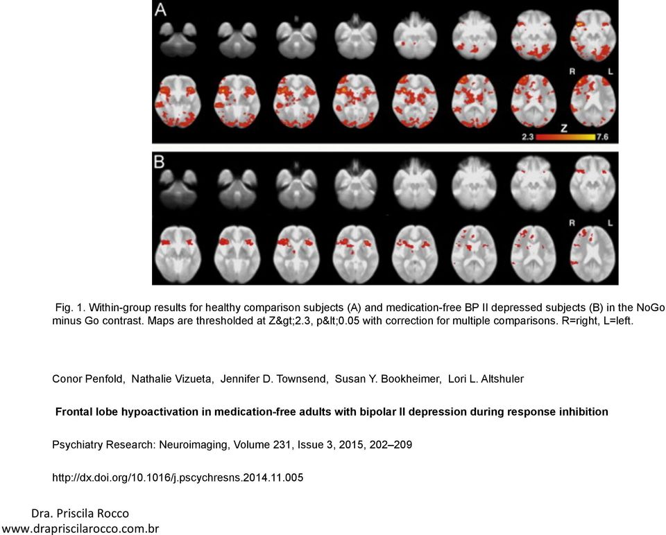 Maps are thresholded at Z>2.3, p<0.05 with correction for multiple comparisons. R=right, L=left. Conor Penfold, Nathalie Vizueta, Jennifer D.