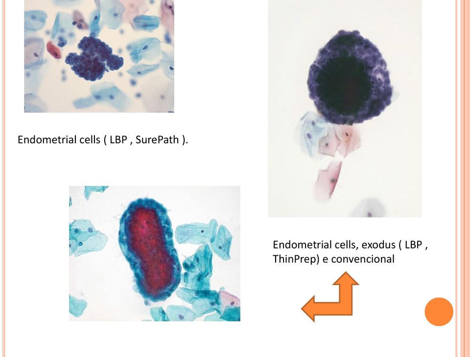 Endometrial cells,