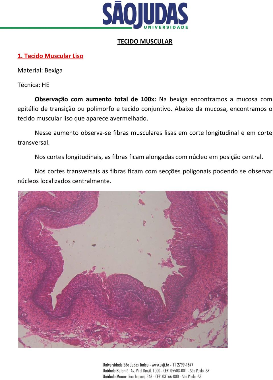 transição ou polimorfo e tecido conjuntivo. Abaixo da mucosa, encontramos o tecido muscular liso que aparece avermelhado.