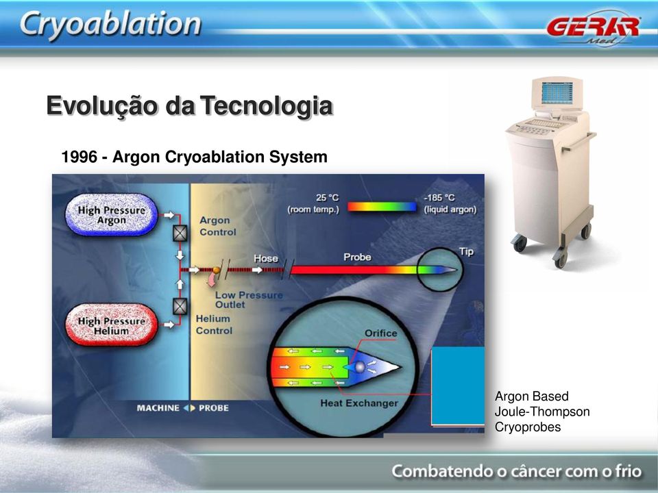 Cryoablation System