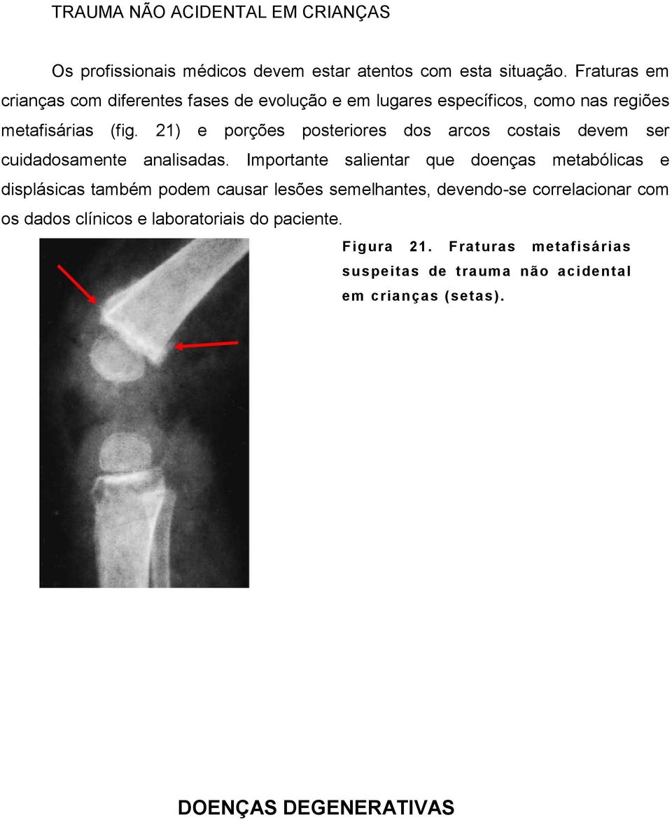 21) e porções posteriores dos arcos costais devem ser cuidadosamente analisadas.