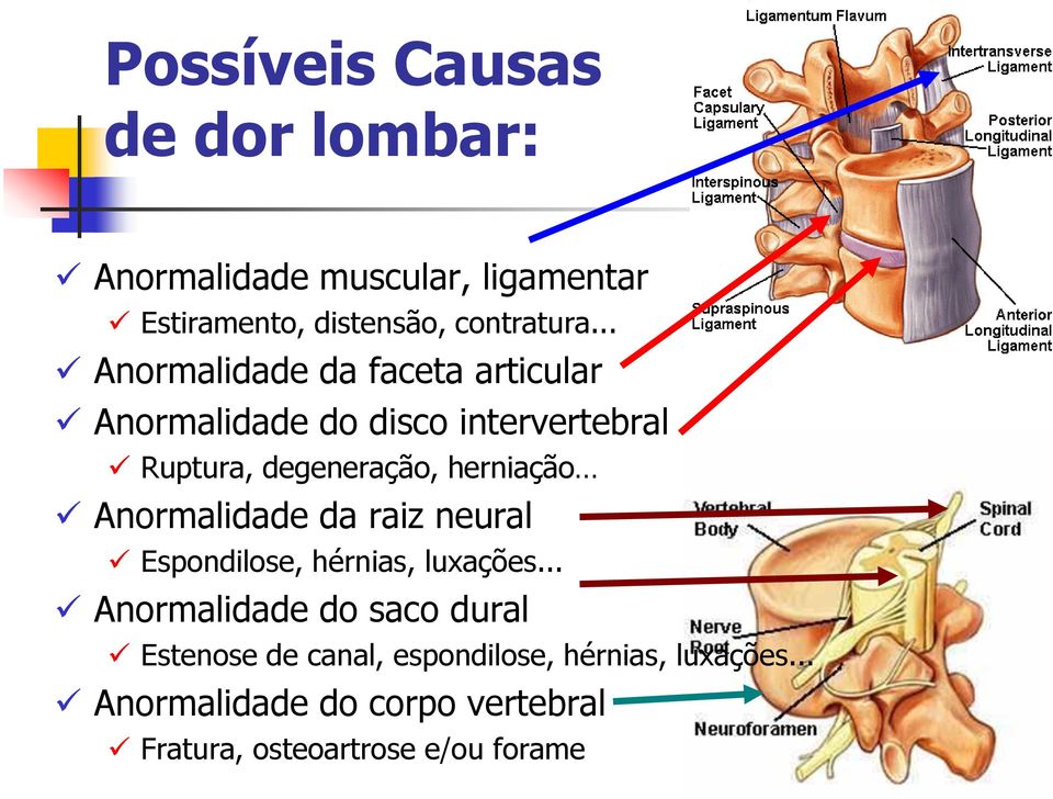 herniação Anormalidade da raiz neural Espondilose, hérnias, luxações.