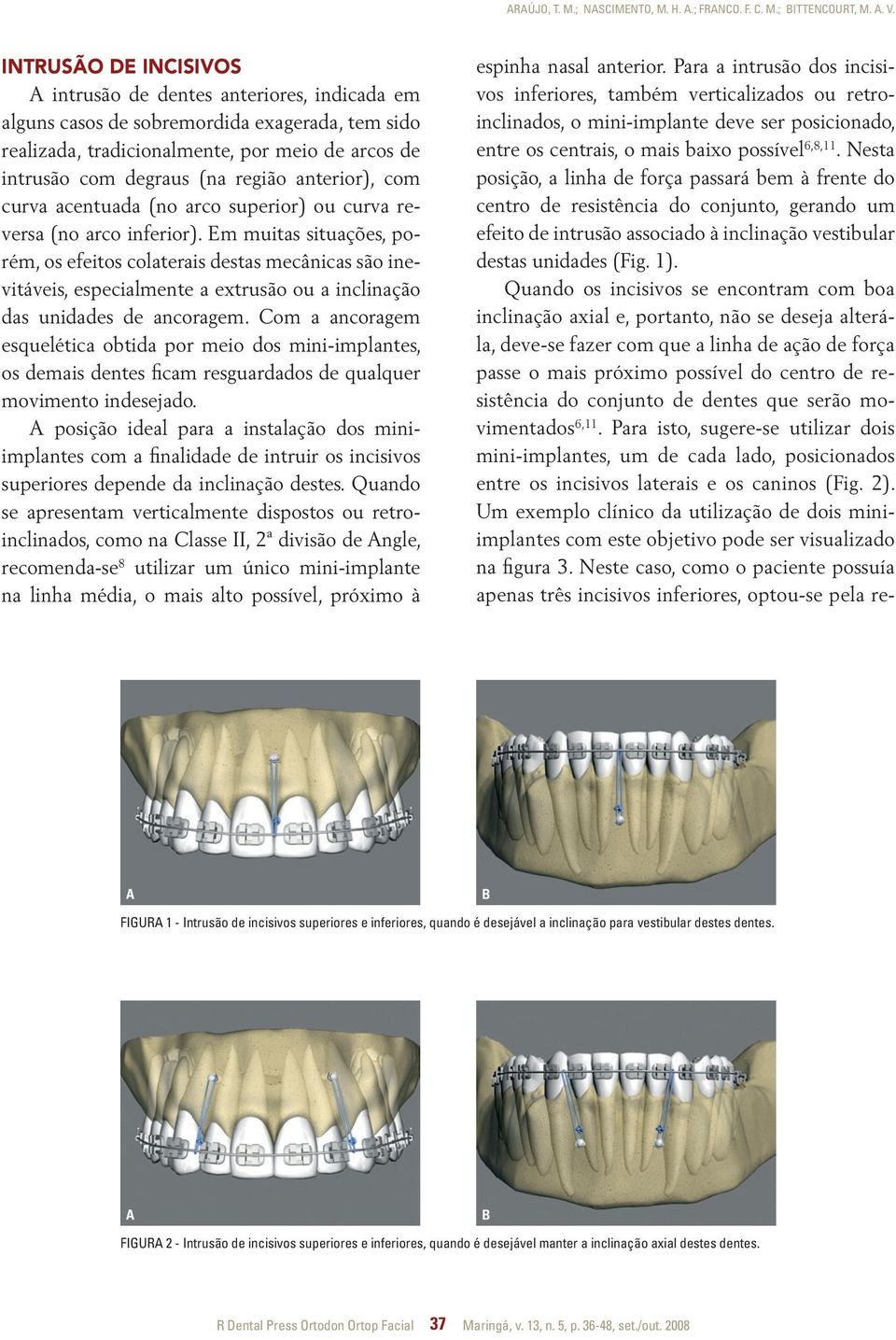 anterior), com curva acentuada (no arco superior) ou curva reversa (no arco inferior).