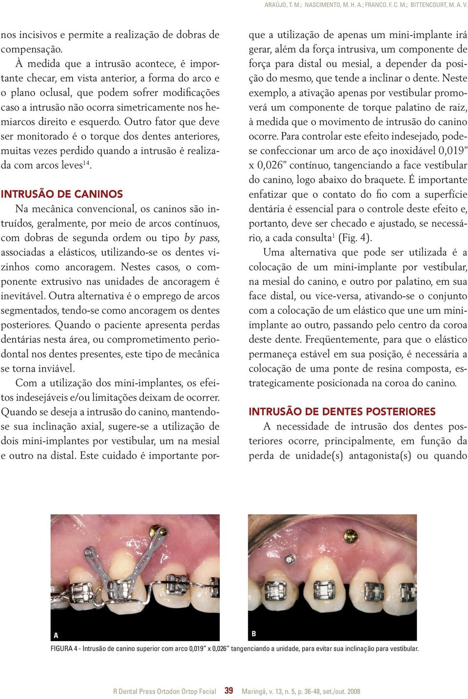 direito e esquerdo. Outro fator que deve ser monitorado é o torque dos dentes anteriores, muitas vezes perdido quando a intrusão é realizada com arcos leves 14.