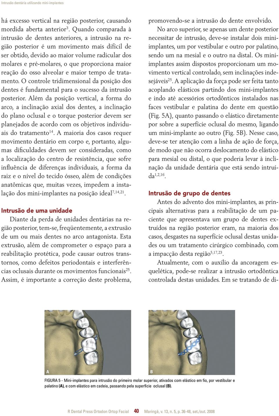 proporciona maior reação do osso alveolar e maior tempo de tratamento. O controle tridimensional da posição dos dentes é fundamental para o sucesso da intrusão posterior.