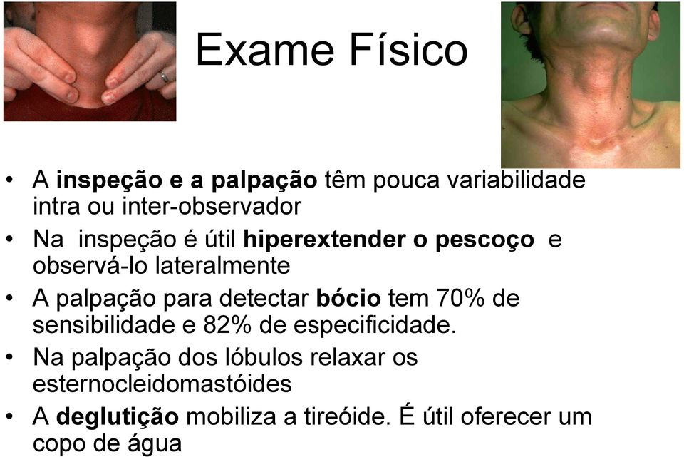 detectar bócio tem 70% de sensibilidade e 82% de especificidade.