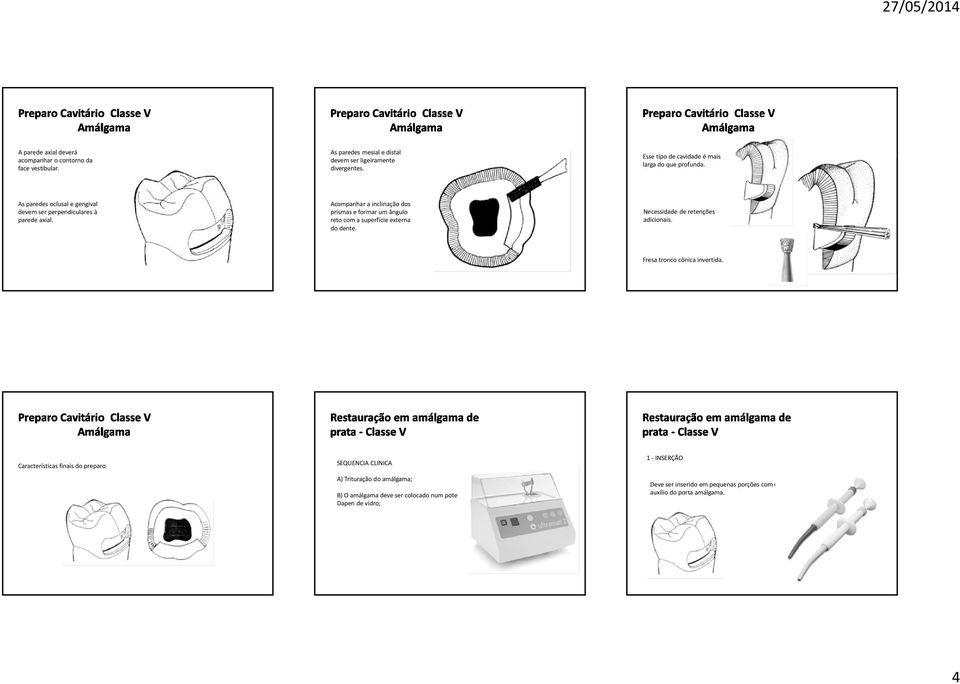 Acompanhar a inclinação dos prismas e formar um ângulo reto com a superfície externa do dente. Necessidade de retenções adicionais.