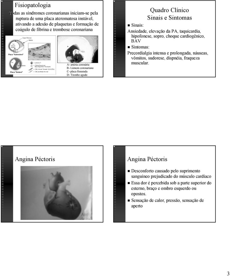 sopro, choque cardiogênico, BAV Sintomas: Precordialgia intensa e prolongada, náuseas, n vômitos, sudorese, dispnéia, ia, fraqueza muscular.