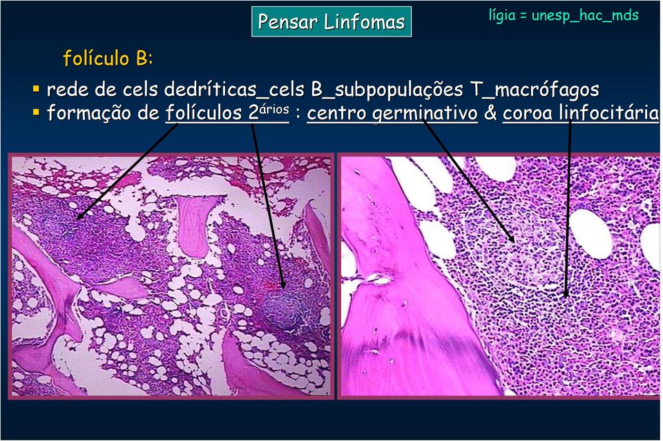 T_macrófagos formação de folículos