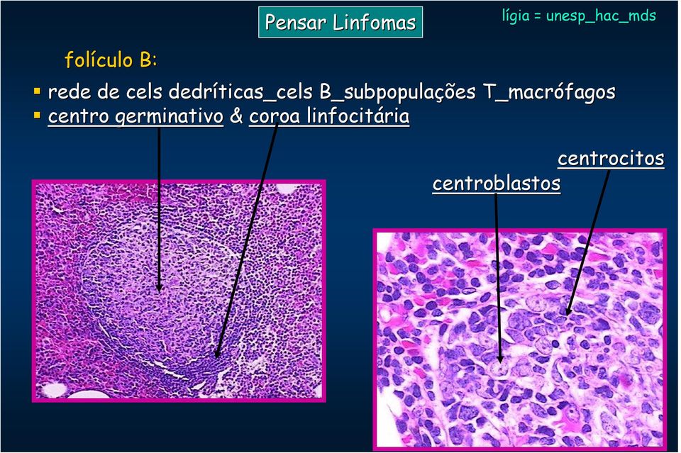 T_macrófagos centro germinativo &