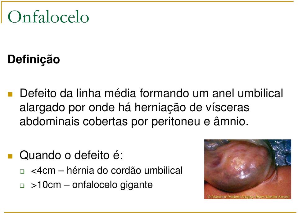 abdominais cobertas por peritoneu e âmnio.