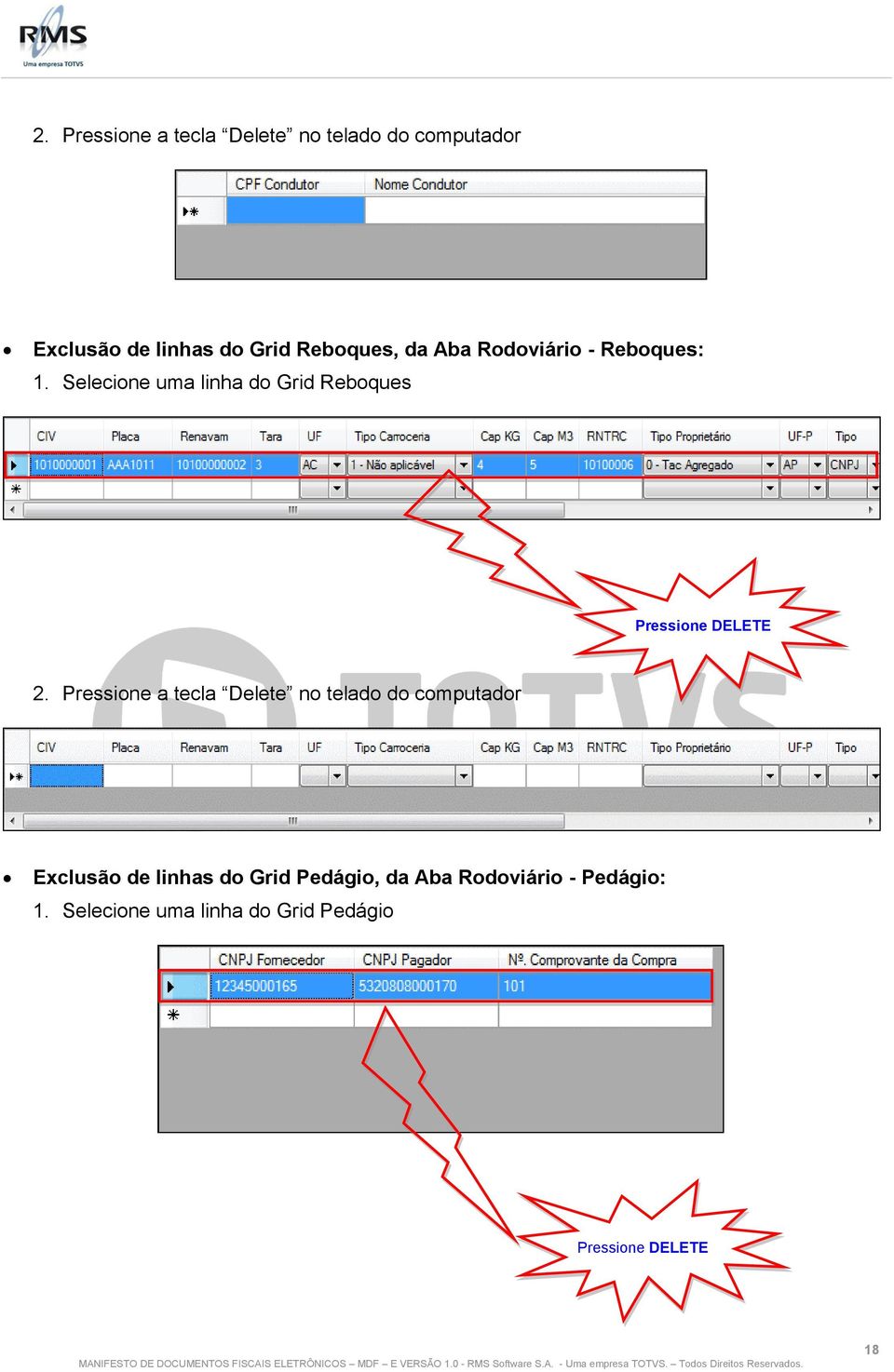 Selecione uma linha do Grid Reboques Pressione DELETE  Pedágio, da Aba Rodoviário -