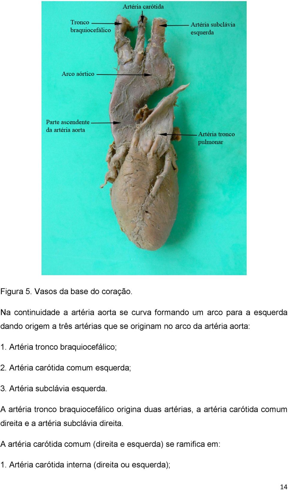 artéria aorta: 1. Artéria tronco braquiocefálico; 2. Artéria carótida comum esquerda; 3. Artéria subclávia esquerda.
