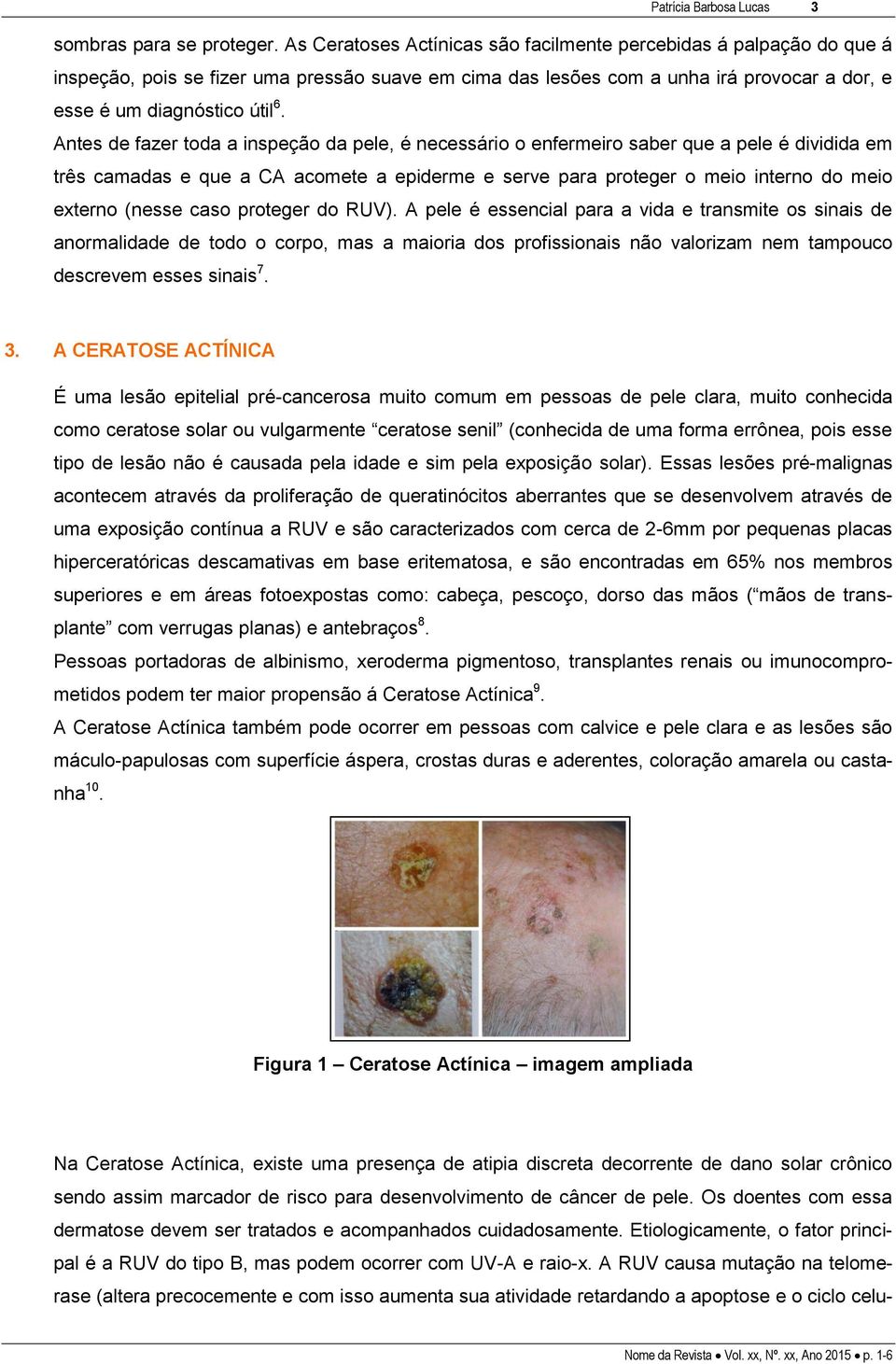 Antes de fazer toda a inspeção da pele, é necessário o enfermeiro saber que a pele é dividida em três camadas e que a CA acomete a epiderme e serve para proteger o meio interno do meio externo (nesse