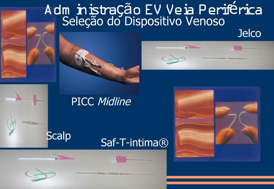 Dispositivo Venoso PICC