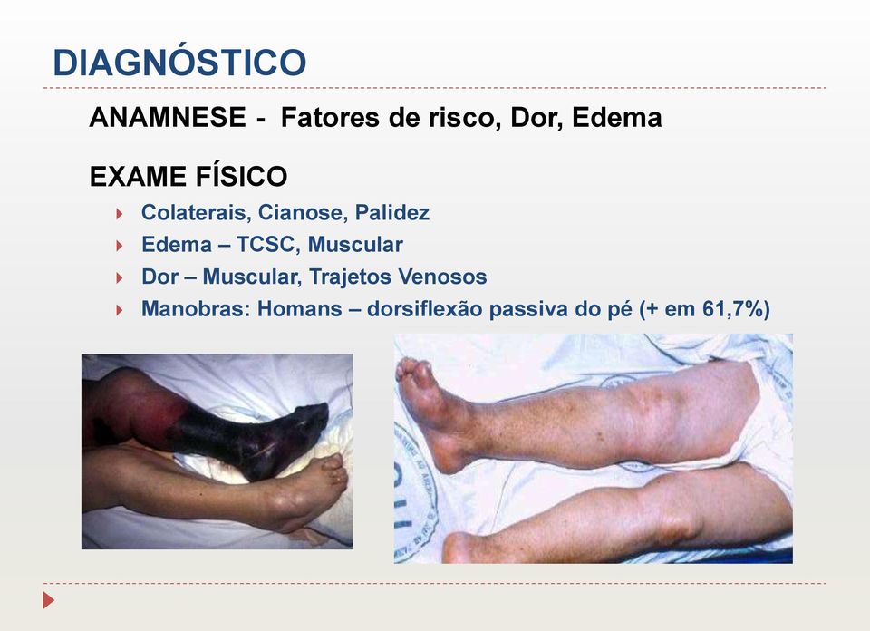 Edema TCSC, Muscular Dor Muscular, Trajetos