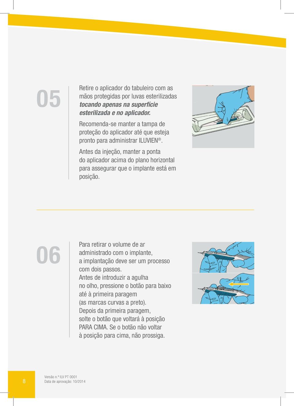 Antes da injeção, manter a ponta do aplicador acima do plano horizontal para assegurar que o implante está em posição.