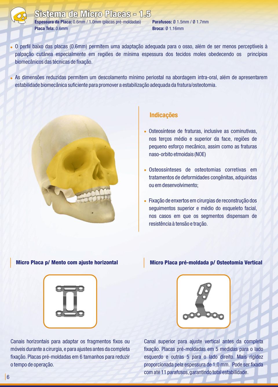 biomecânicos das técnicas de fixação.