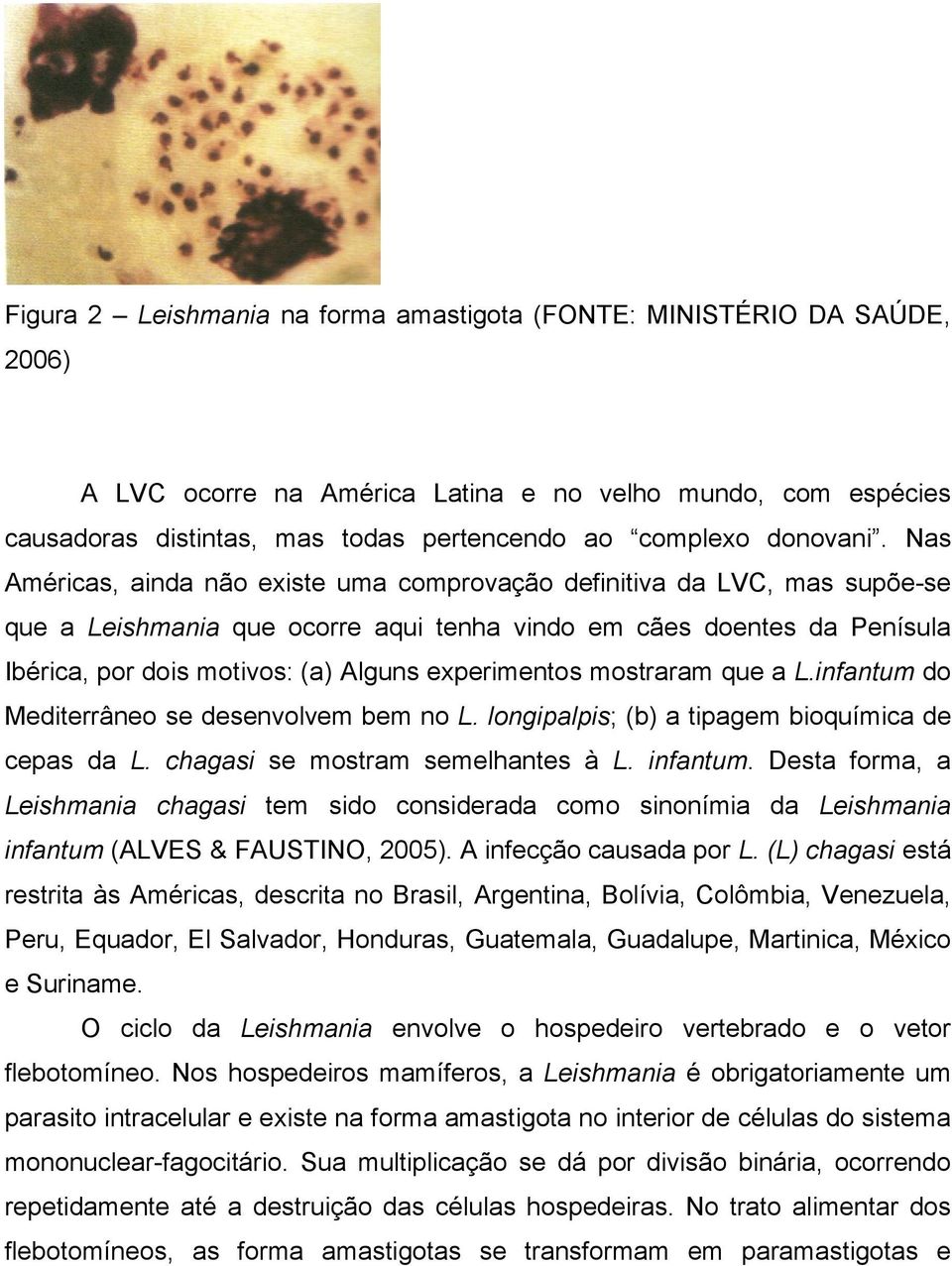 Nas Américas, ainda não existe uma comprovação definitiva da LVC, mas supõe-se que a Leishmania que ocorre aqui tenha vindo em cães doentes da Penísula Ibérica, por dois motivos: (a) Alguns