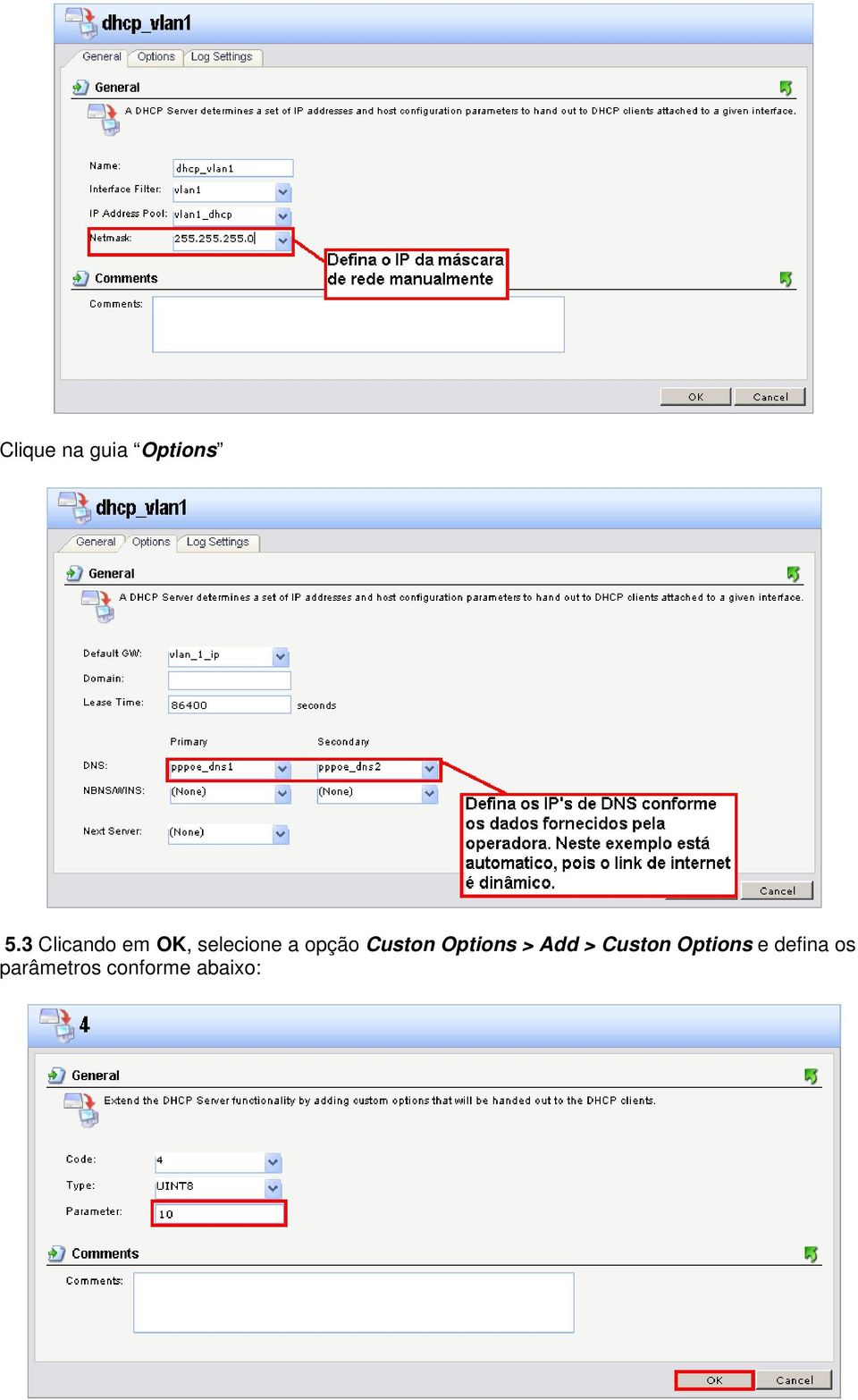 opção Custon Options > Add >