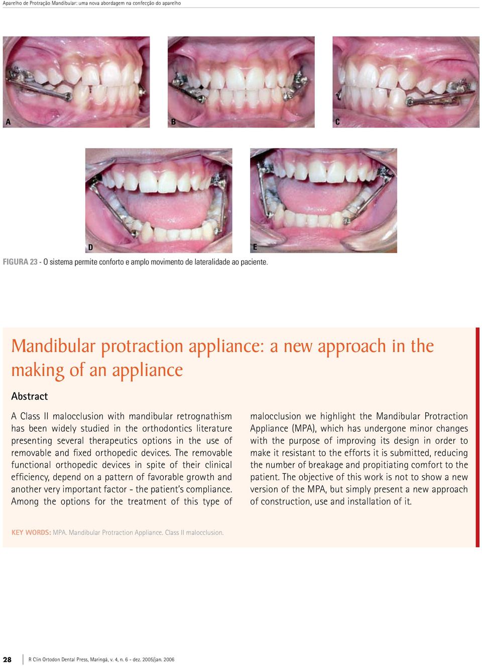 presenting several therapeutics options in the use of removable and fixed orthopedic devices.