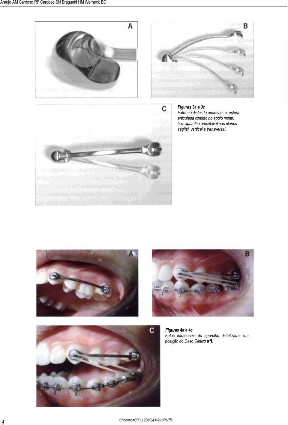 aparelho articulável nos planos sagital, vertical e transversal.