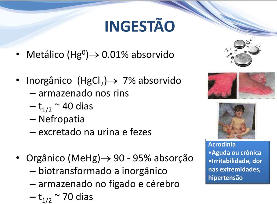 Nefropatia excretado na urina e fezes Orgânico (MeHg) 90-95% absorção