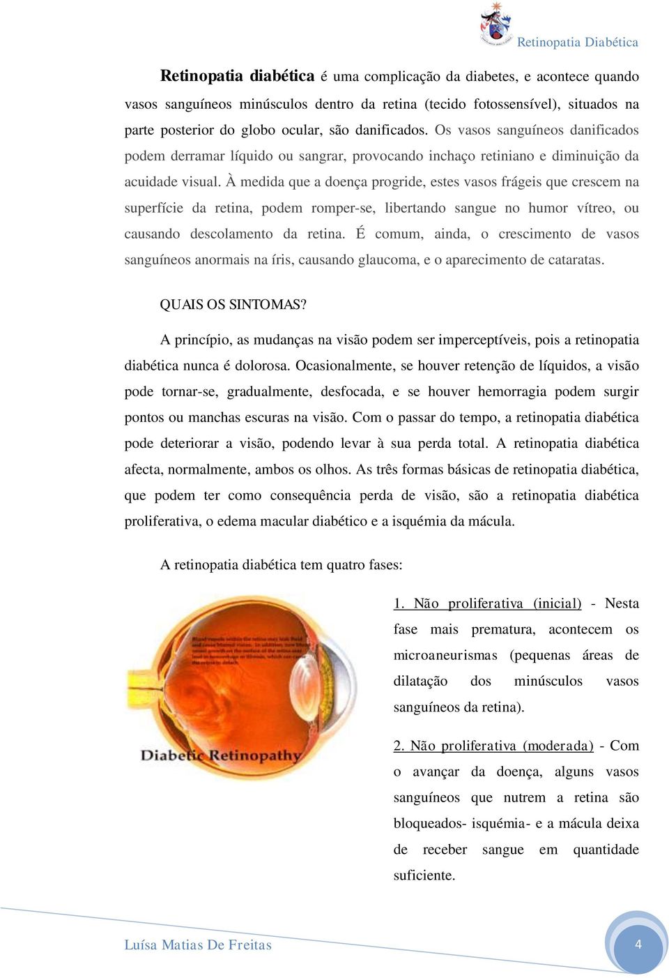 À medida que a doença progride, estes vasos frágeis que crescem na superfície da retina, podem romper-se, libertando sangue no humor vítreo, ou causando descolamento da retina.