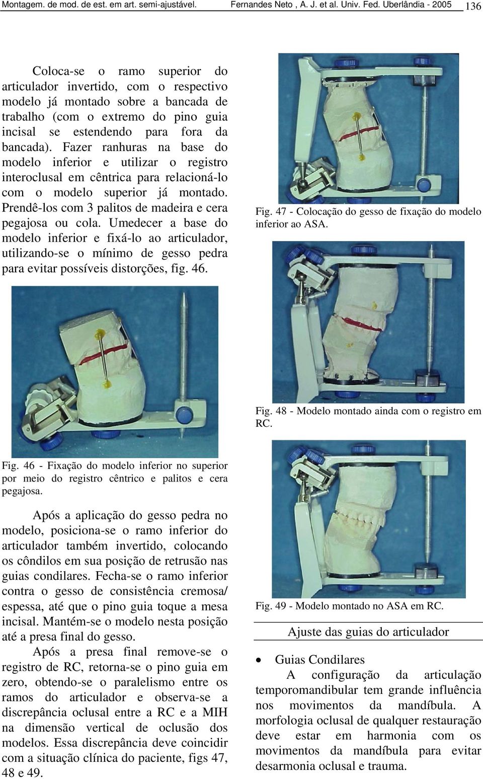 bancada). Fazer ranhuras na base do modelo inferior e utilizar o registro interoclusal em cêntrica para relacioná-lo com o modelo superior já montado.