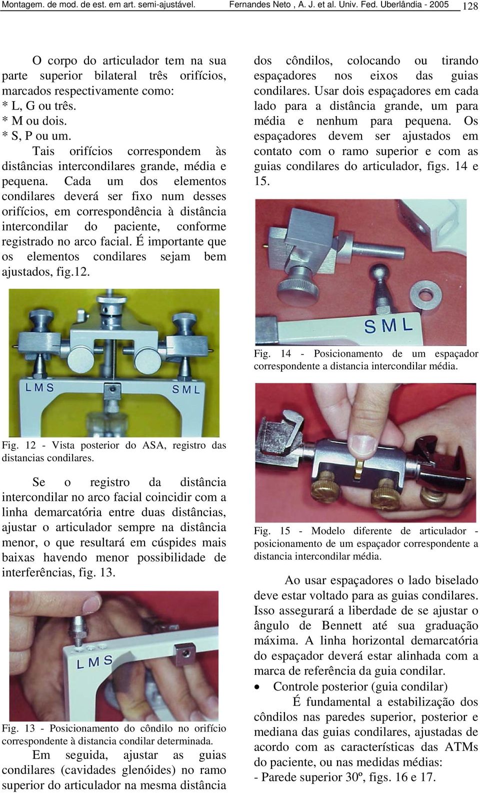 Tais orifícios correspondem às distâncias intercondilares grande, média e pequena.