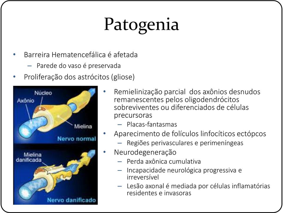 Placas-fantasmas Aparecimento de folículos linfocíticos ectópcos Regiões perivasculares e perimeníngeas Neurodegeneração Perda