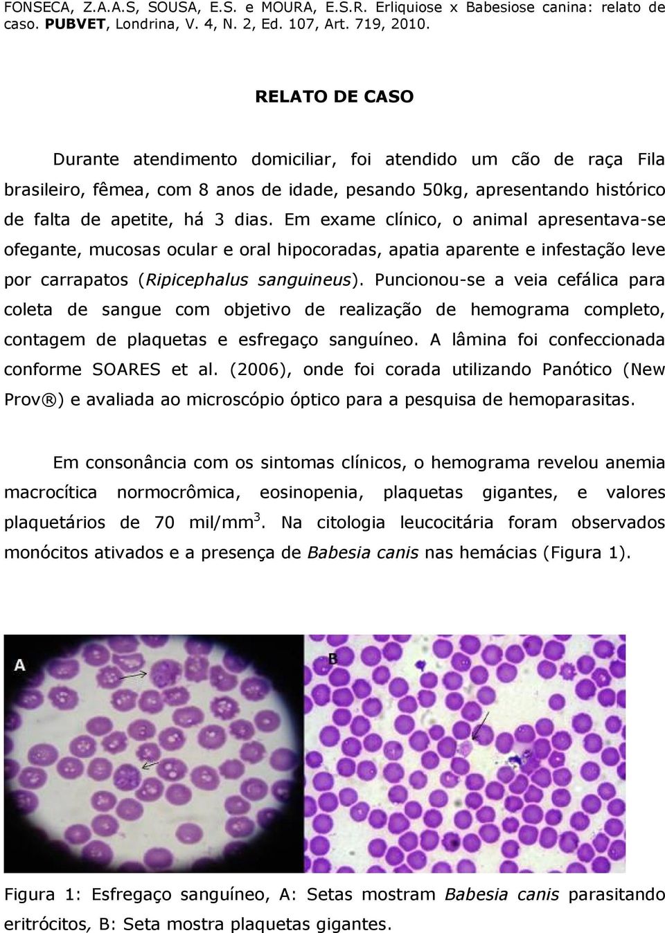 Puncionou-se a veia cefálica para coleta de sangue com objetivo de realização de hemograma completo, contagem de plaquetas e esfregaço sanguíneo. A lâmina foi confeccionada conforme SOARES et al.