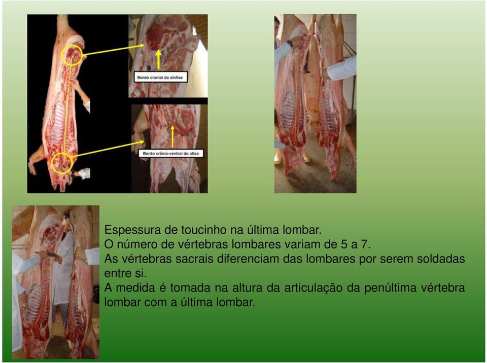 As vértebras sacrais diferenciam das lombares por serem