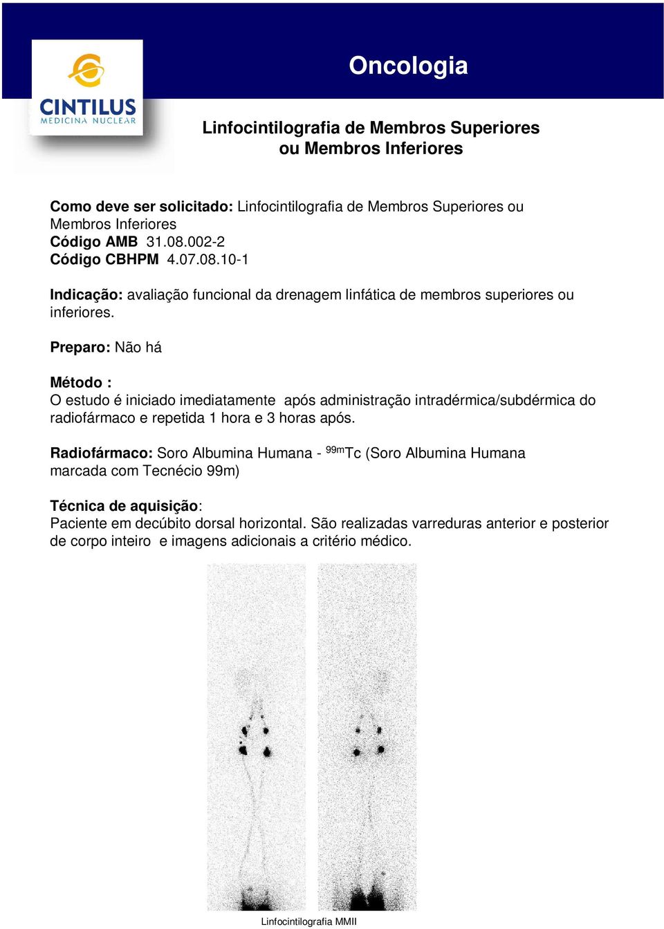 Preparo: Não há O estudo é iniciado imediatamente após administração intradérmica/subdérmica do radiofármaco e repetida 1 hora e 3 horas após.