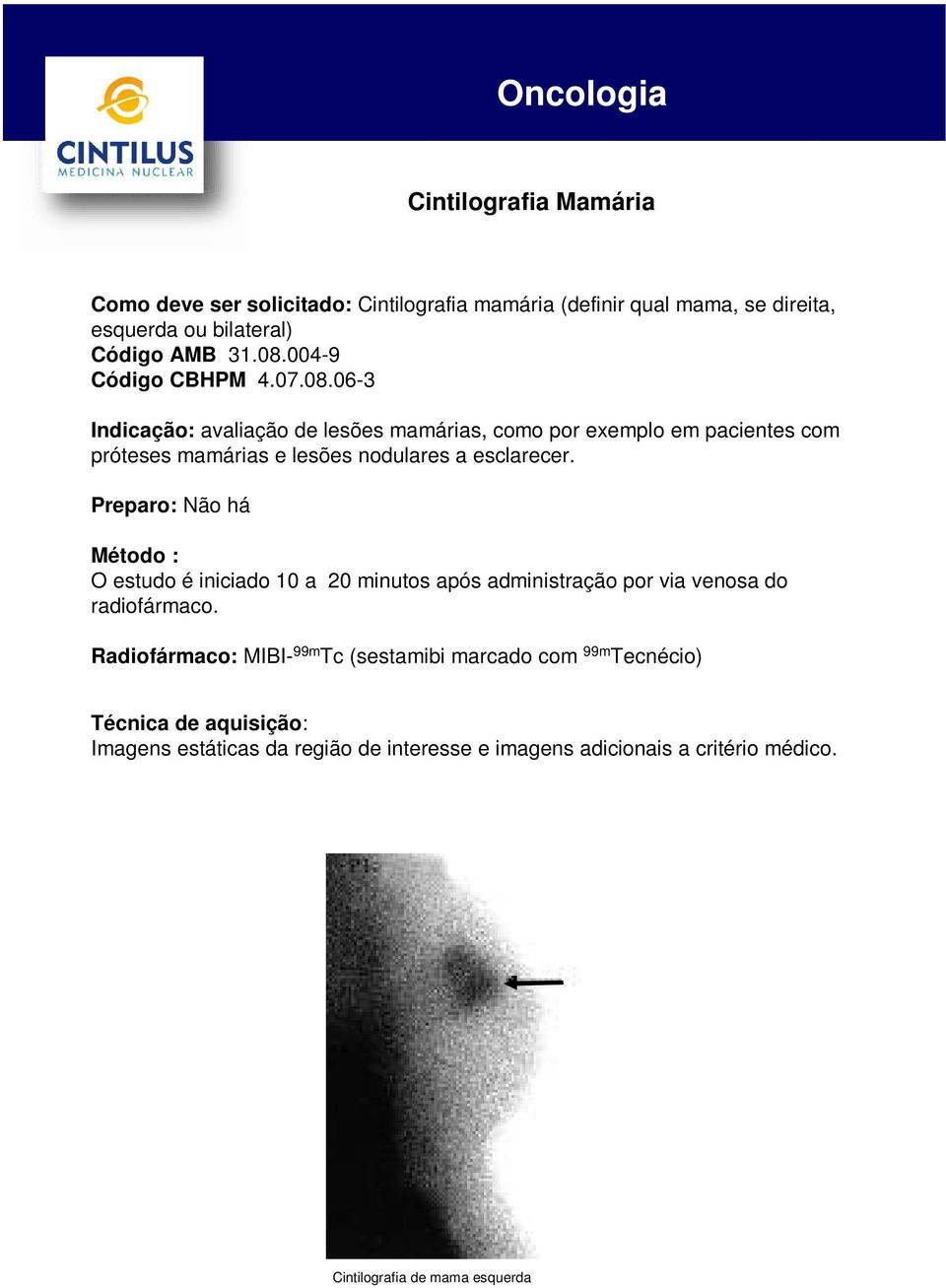 06-3 Indicação: avaliação de lesões mamárias, como por exemplo em pacientes com próteses mamárias e lesões nodulares a esclarecer.