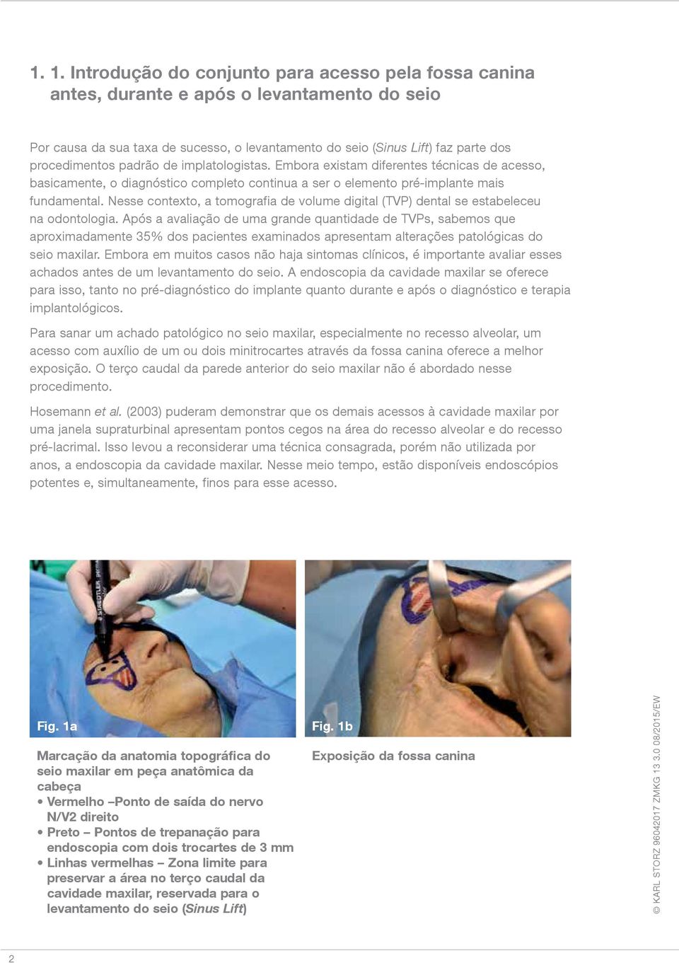 Nesse contexto, a tomografia de volume digital (TVP) dental se estabeleceu na odontologia.