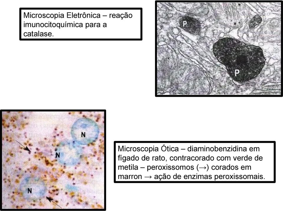 Microscopia Ótica diaminobenzidina em fígado de rato,