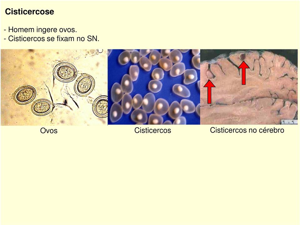 - Cisticercos se fixam no