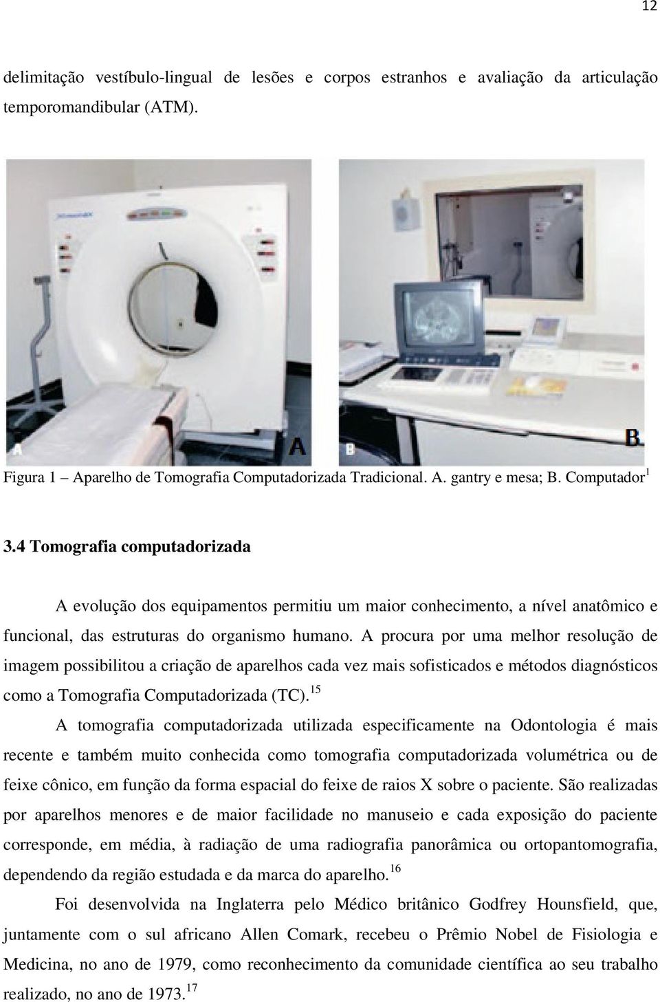 A procura por uma melhor resolução de imagem possibilitou a criação de aparelhos cada vez mais sofisticados e métodos diagnósticos como a Tomografia Computadorizada (TC).