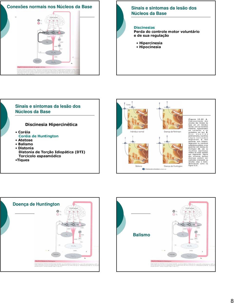 B. N o s d o e n t e s parkinsonianos, neurônios n e g r o - e s t r i a d o s dege ner am. C.